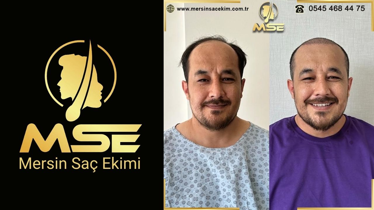 Mersin Sa Ekimi
